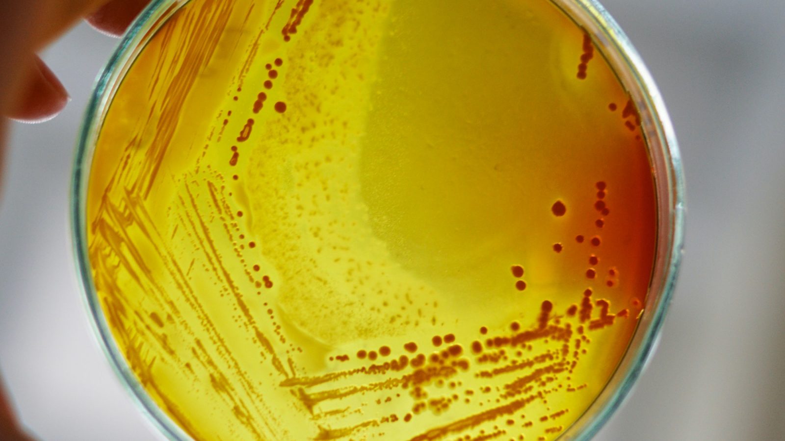 'Antimicrobial resistance the biggest health challenge of our time